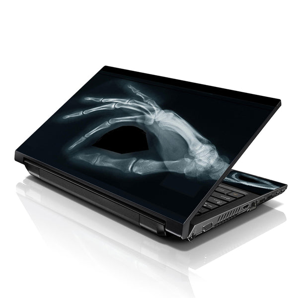 Laptop Notebook Skin Decal with 2 Matching Wrist Pads - Skeleton Head Scan